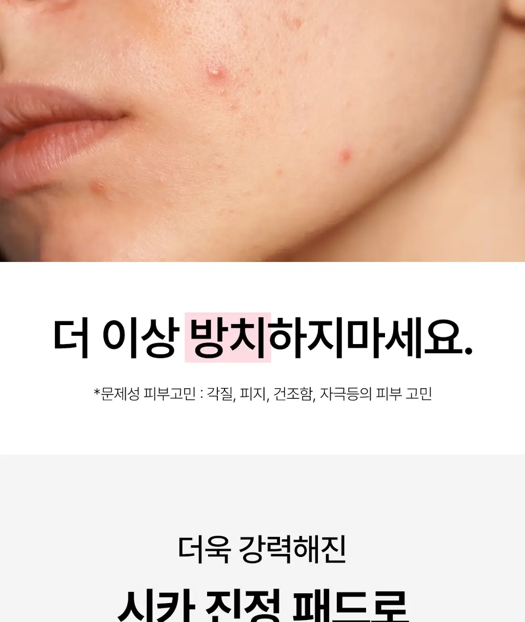 [진정패드/대용량] 네오젠 카밍 시카&티트리 진정 토너 패드 90매 상세페이지 4